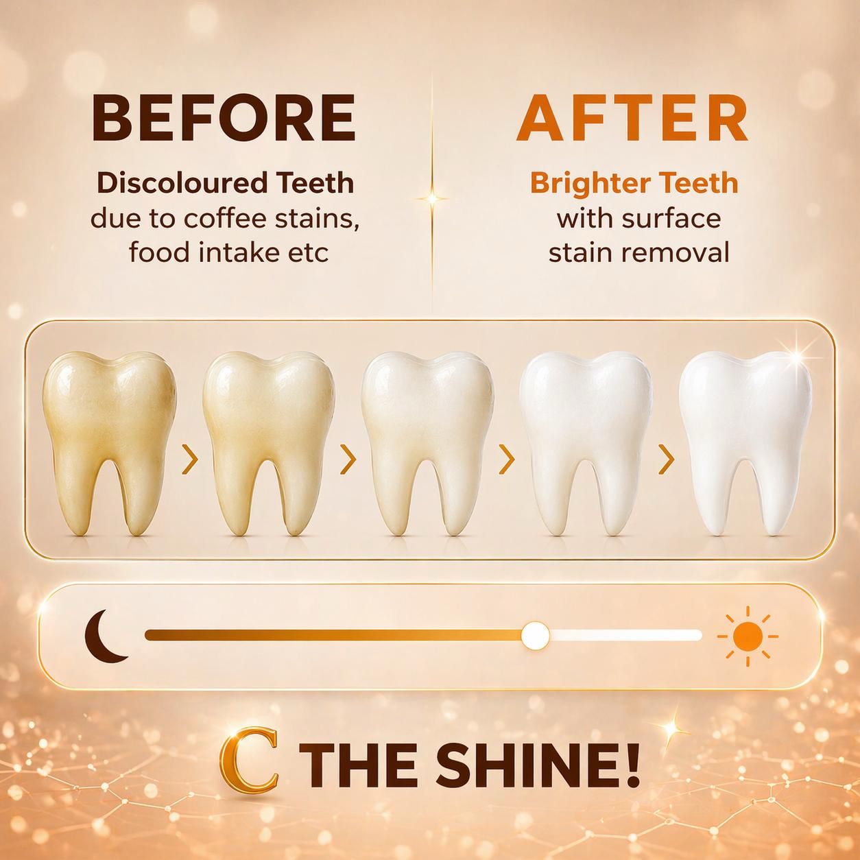 BENTODENT TOOTHPASTE Advance Whitamin Teeth Whitening Toothpaste, Vitamin C, 5% Nano Hydroxyapatite, Enamel Repair, 100g